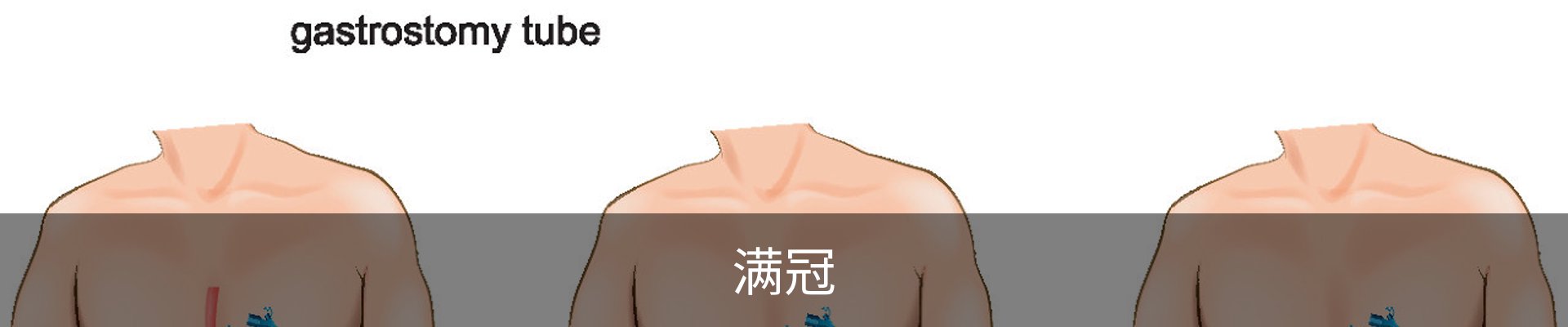 满冠